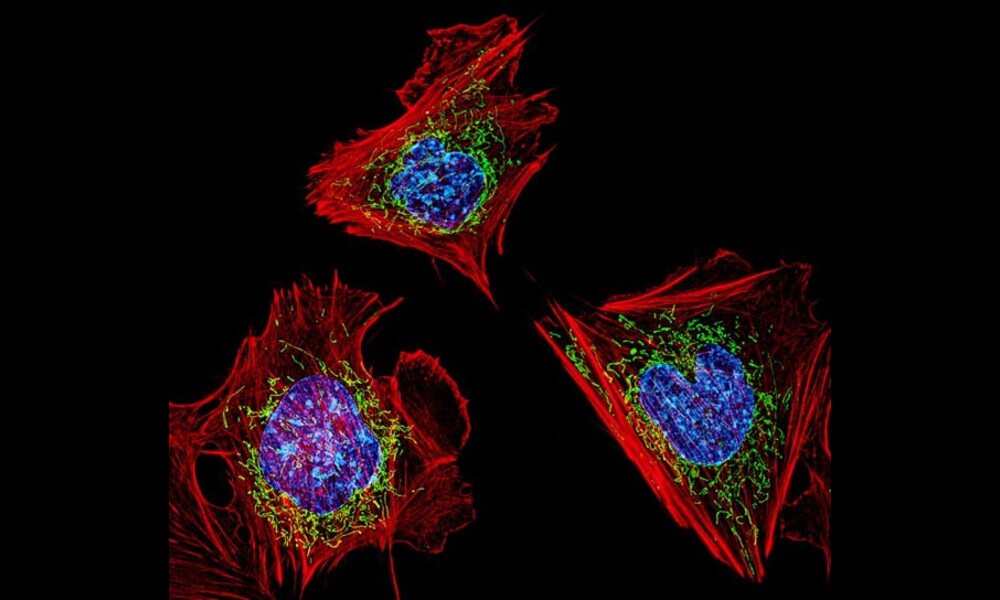 Cells with nuclei in blue, energy factories in green and the actin cytoskeleton in red | NIH Image Gallery on Flickr