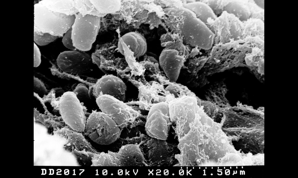 File:Yersinia pestis scanned with electron micrograph.jpg | Ww2censor on Wikimedia